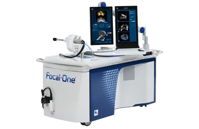 의사가-focal-one,-unfold-ai를-사용한-최초의-로봇식-고강도-초음파-시술에-대해-설명합니다. 의사가-focal-one,-unfold-ai를-사용한-최초의-로봇식-고강도-초음파-시술에-대해-설명합니다.