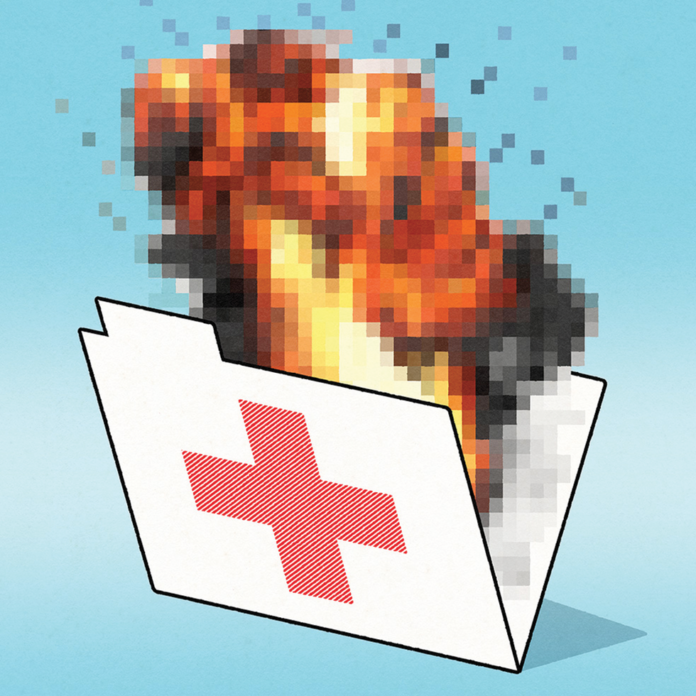 너무-빨리-움직이며-위험한-체계적인-블로우-백